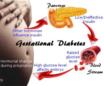 Diabetes Gestational