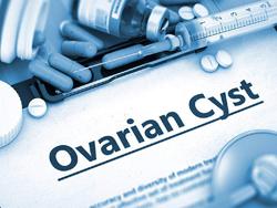 Simple ovarian cyst dont require surgery